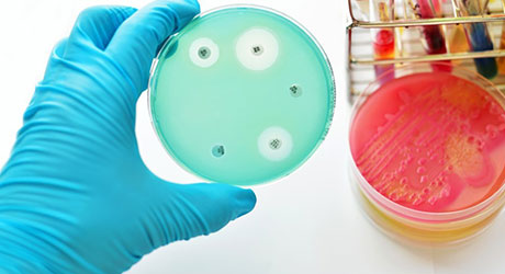 Developing new antibiotics key for the race against resistant infections, says ABPI