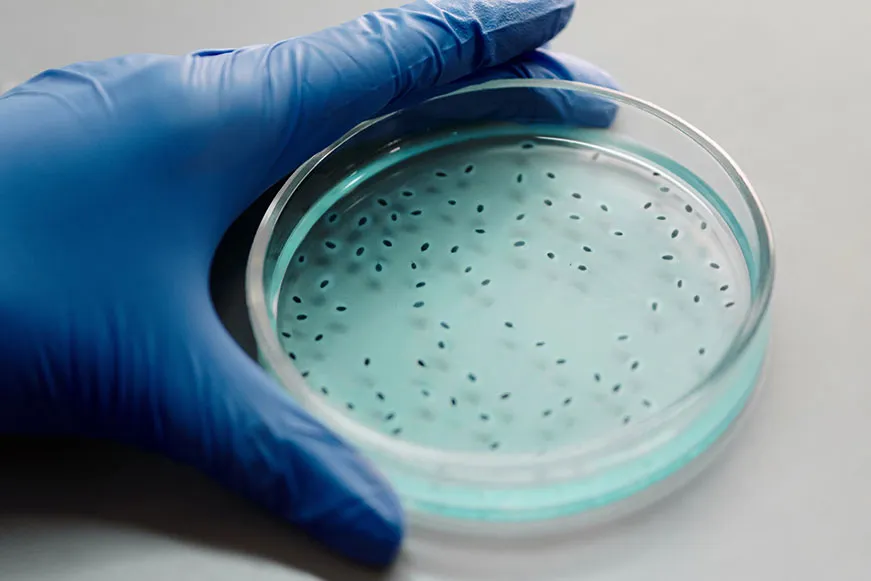 Open Petri dish with spots on the culture being held in surgical purple gloved left-hand